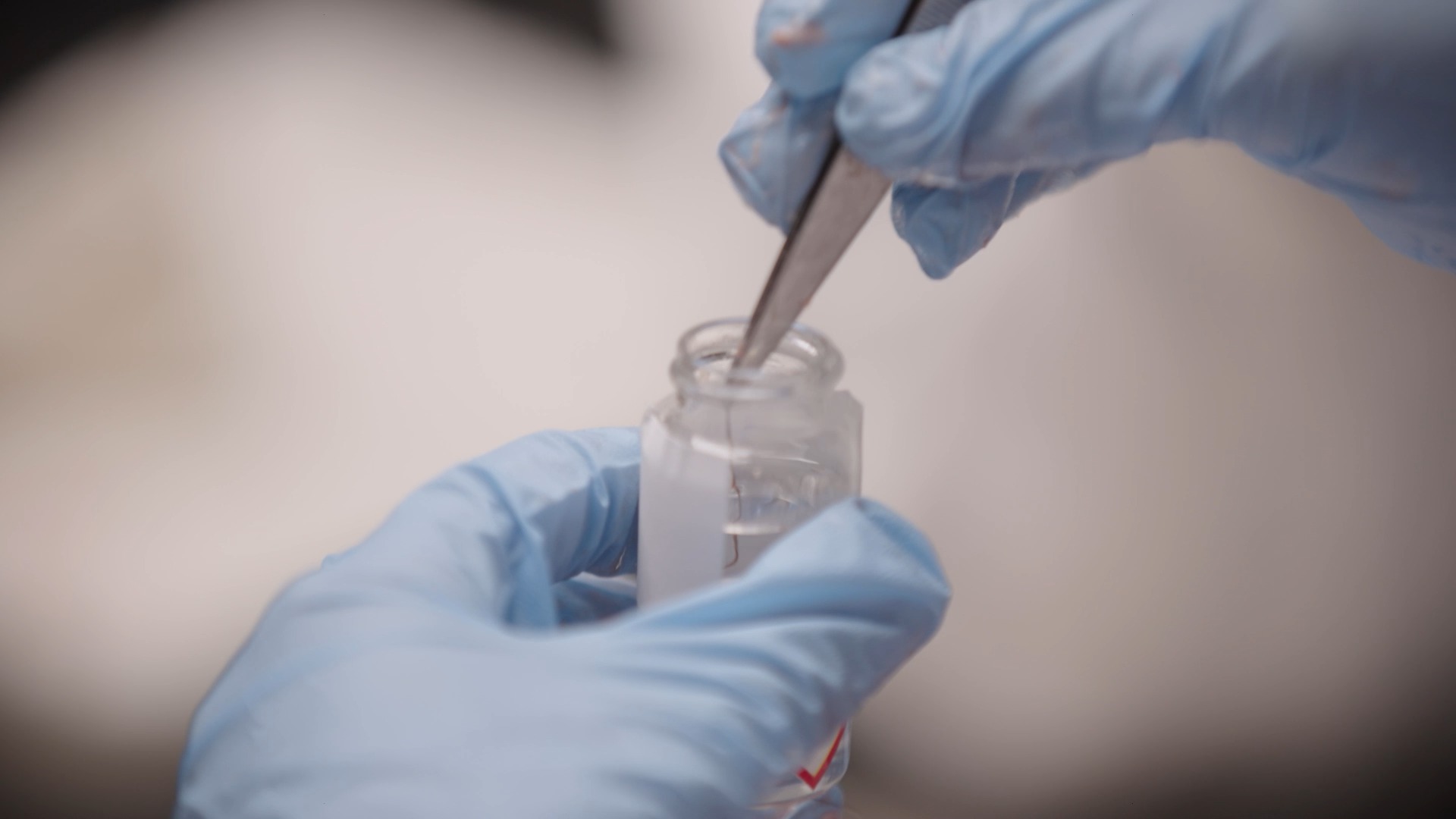 Le trouble dans les méninges!